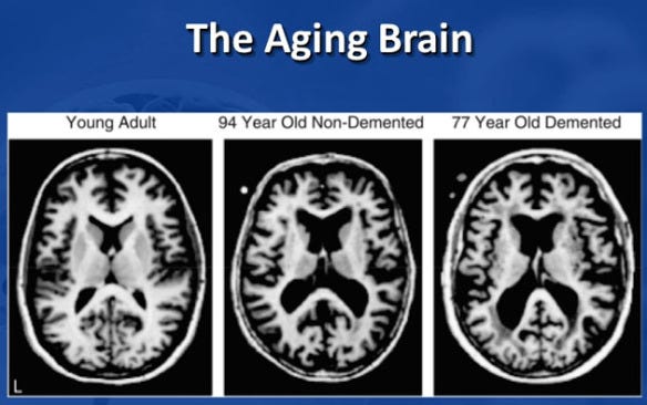 Older Brains Replenish Cells Just Like Young Brains: Study | Cooking with  Kathy Man