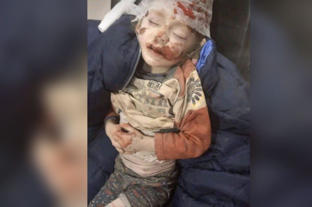 A tiny child with blood covering their pale, dusted face, with bandages covering their head.