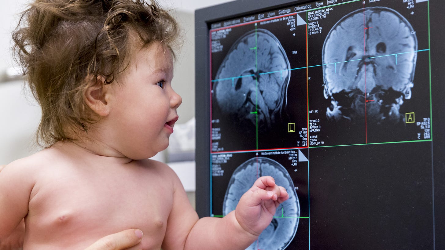 Infant Brains Reveal How the Mind Gets Built | Quanta Magazine