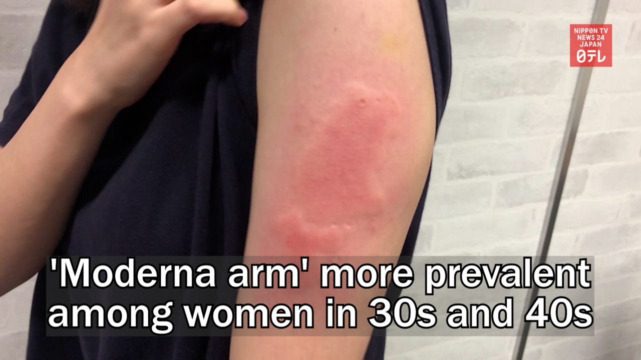 Moderna arm more prevalent among women in 30s and 40s | Nippon TV NEWS 24  JAPAN