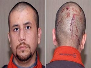 George Zimmerman