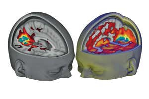 Multicoloured brain scans