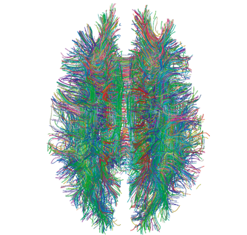White Matter Connections Obtained with MRI Tractography