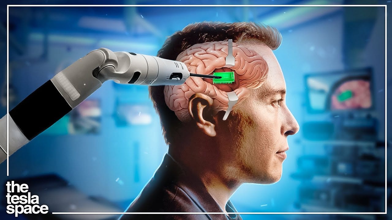 Neuralink Preparing For Human Trials In 2022! - YouTube