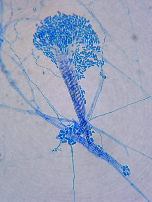 Fun With Microbiology (What's Buggin' You?): Pseudallescheria  boydii/Scedosporium apiospermum