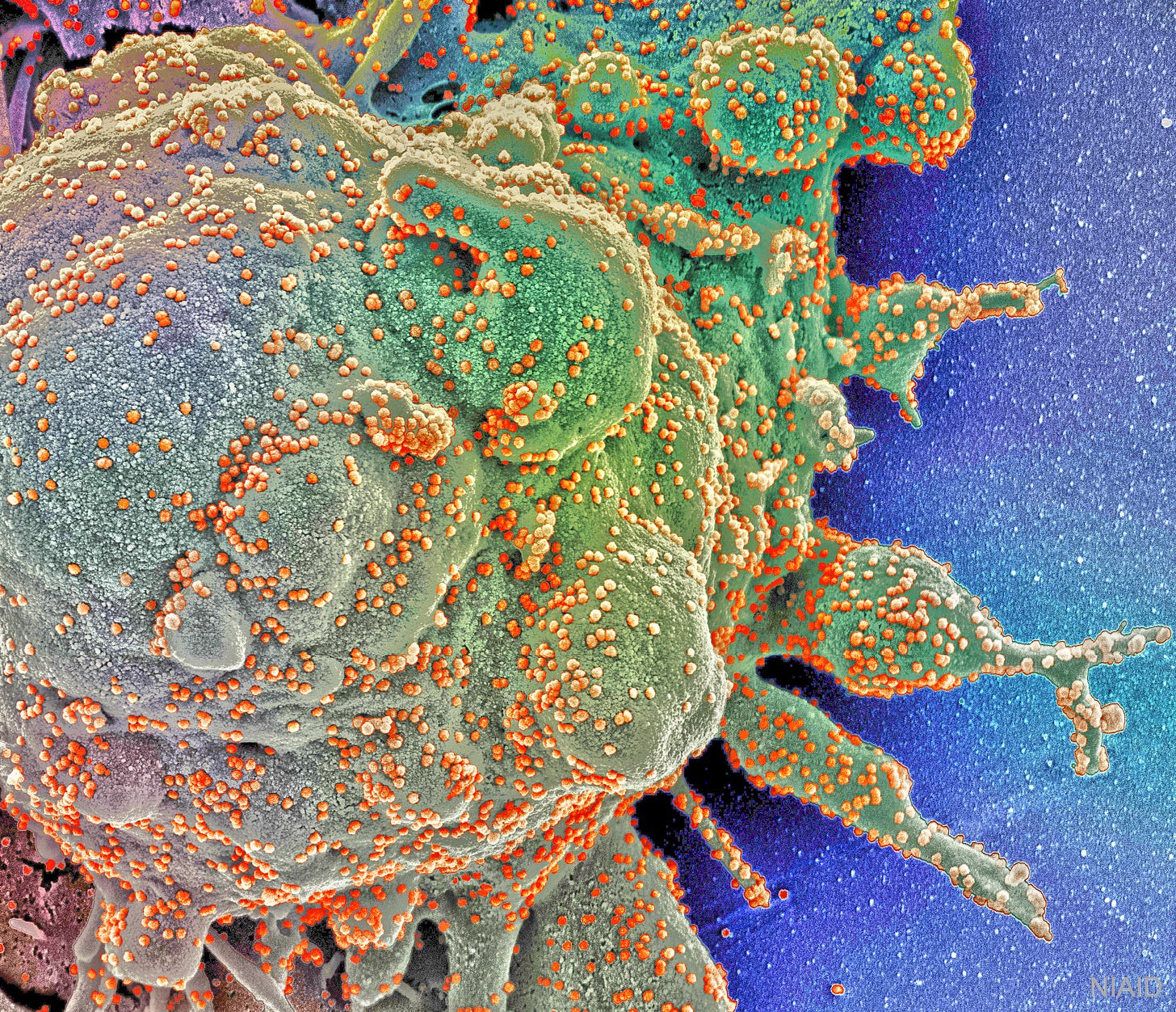 Edited NIAID/NIH microscopic image of a human cell being attacked by coronaviruses.