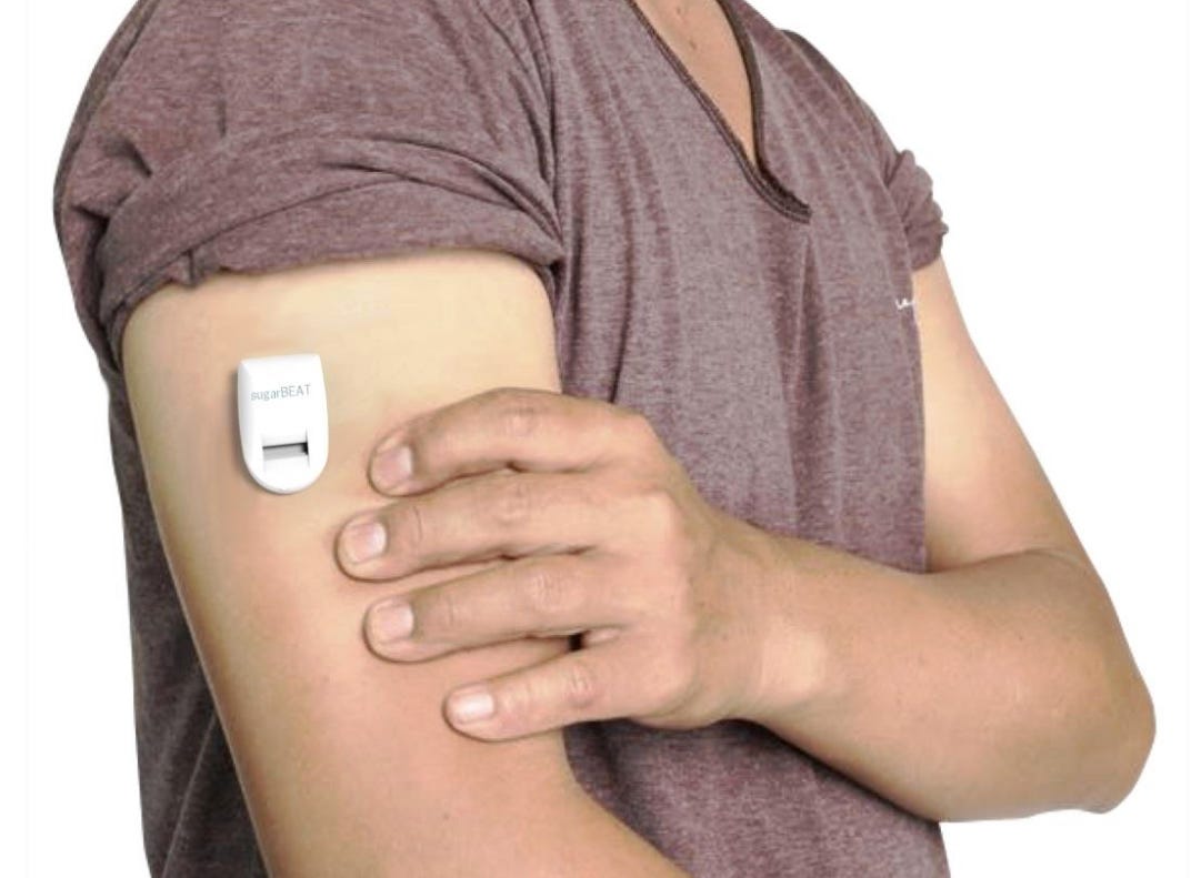 SugarBEAT: First No-Needles Glucose Monitor SugarBEAT: First No-Needles Glucose Monitor
