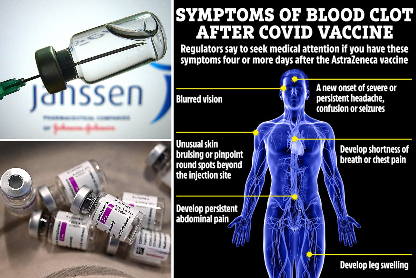 The signs you could be suffering extremely rare blood clots 'linked to AstraZeneca and Janssen ...