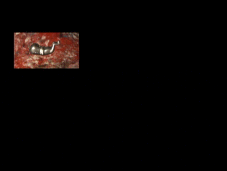 An animation from a video excerpt. A black screen has six smaller embedded screens of a different rainbow color of fabric with a silver fetus floating in front of it. 