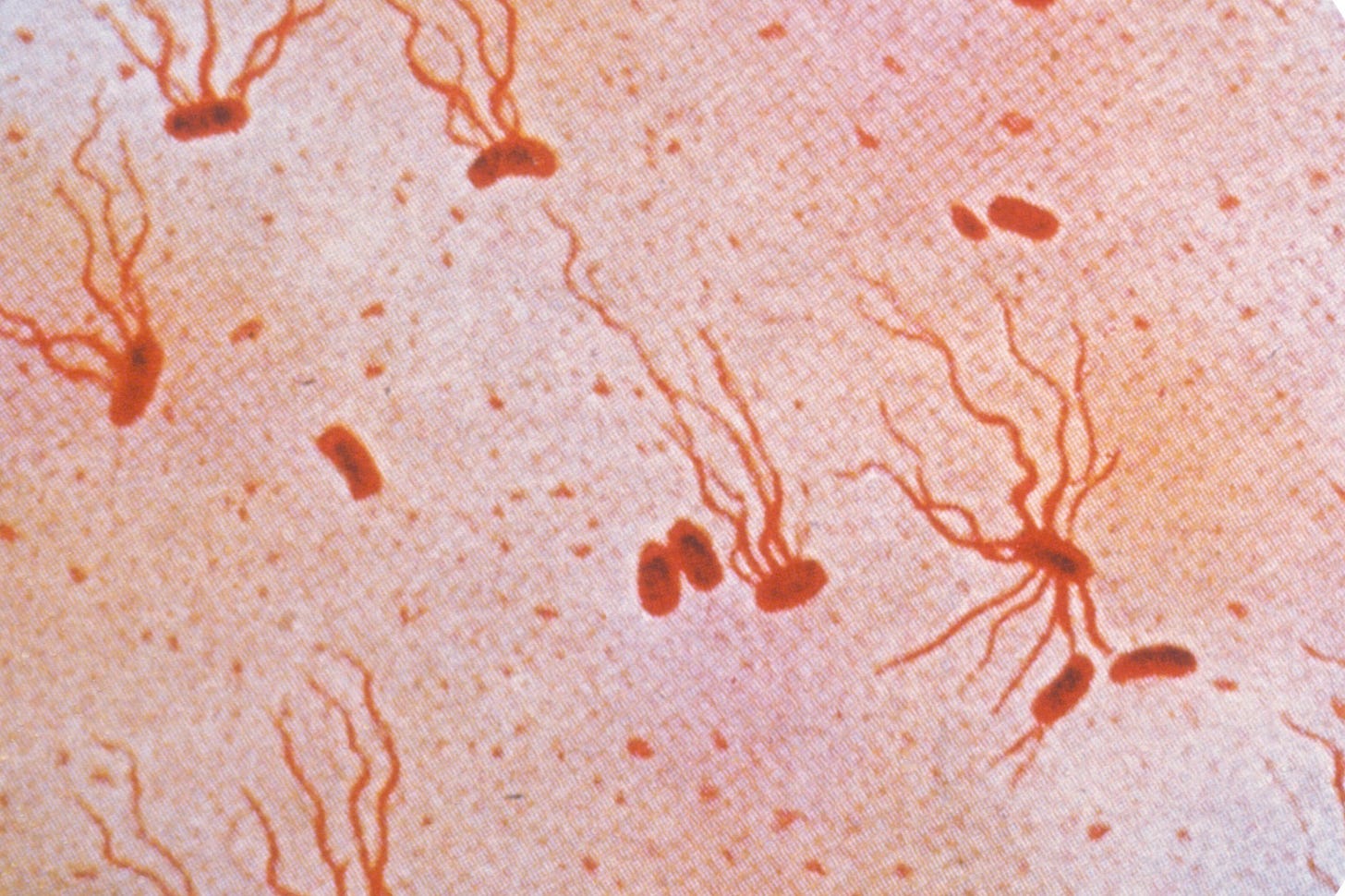 A photomicrograph of S. Typhi bacteria.