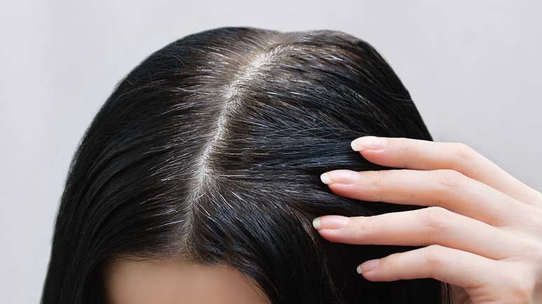 what causes gray hair