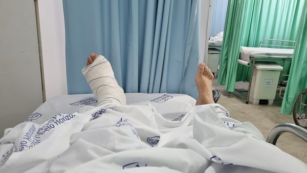 Pessoa com uma perna engessada numa cama de hospital, só as pernas aparecem, na frente delas uma cortina azul