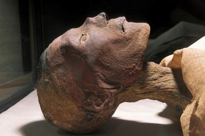 Traces of smallpox pustules found on the head of the 3000-year-old mummy of the Pharaoh Ramses V. Photo courtesy of World Health Organization (WHO)