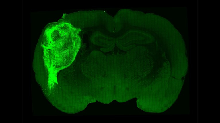 Micrograph of a human brain organoid in a rat brain
