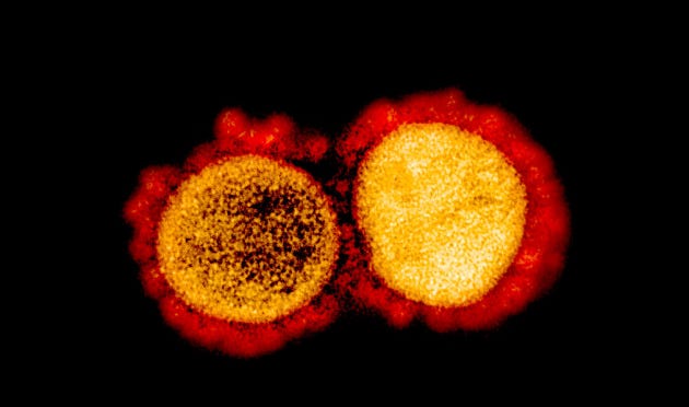 Debunked: Yes, the virus that causes Covid-19 has been isolated and  photographed