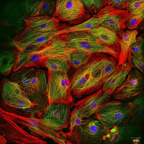 Immunostaining of human cardiomyocytes with antibodies for actin (red), myomesin (green), and nuclei (blue).