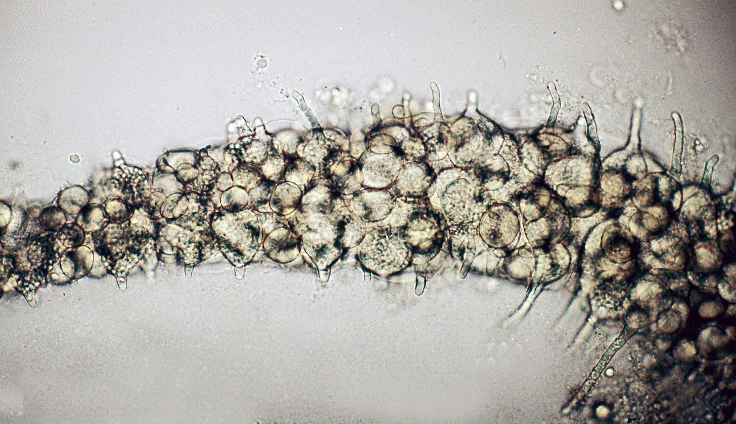 Catenaria anguillulae - massive infection of nema