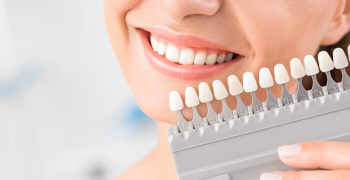 Resina composta para Odontologia: o que você precisa saber : Surya Dental