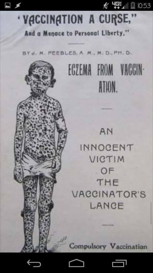 May be an image of text that says "4GE + VACCINATION A CURSE," And a Menace to Personal Liberty," PEEBLES, ECZEMA FROM VACCIN- ATION. AN INNOCENT VICTIM OF THE VACCINATOR'S LANCE Compulsory Vaccinatian"