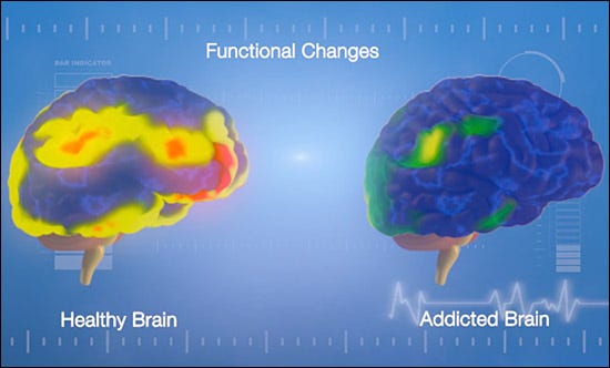 Understanding Addiction Reward And Pleasure In The Brain | Inspire Malibu
