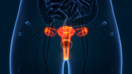 Ovarian Cancer - Or Is It? - Health News | University of ...