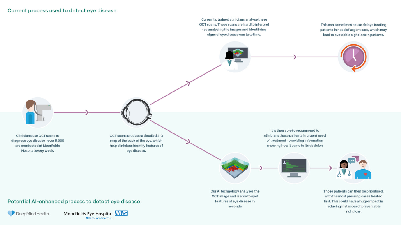 Potential AI-enhanced process to detect eye disease