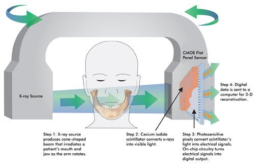 CMOS technology for digital dental imaging | Features | Apr 2010 |  BioPhotonics