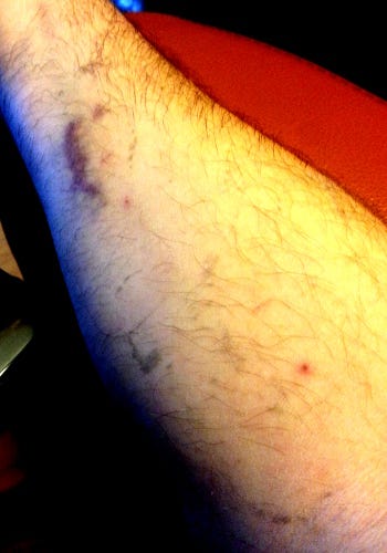arm arm