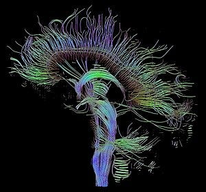 English: Visualization of a DTI measurement of...