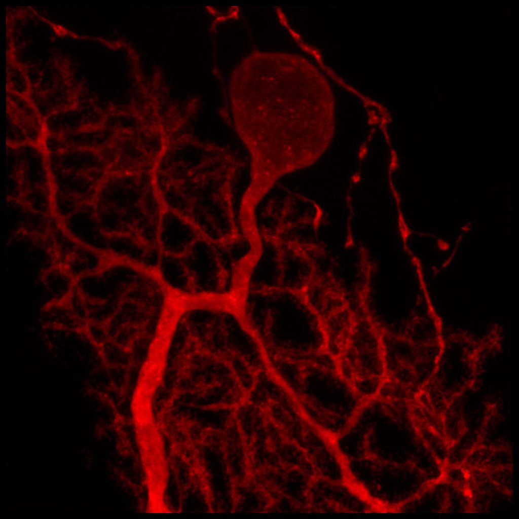 Cerebellum Purkinje cell, confocal microscopy