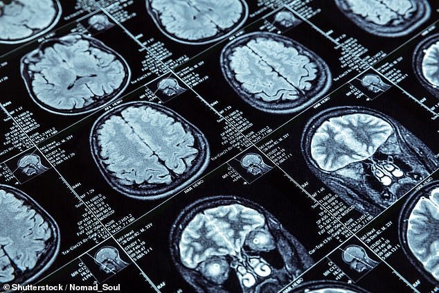 Scientists from the University of Oxford examined the brains of 785 participants aged 51-81 who had received MRI scans both before and during the pandemic. (Stock image)