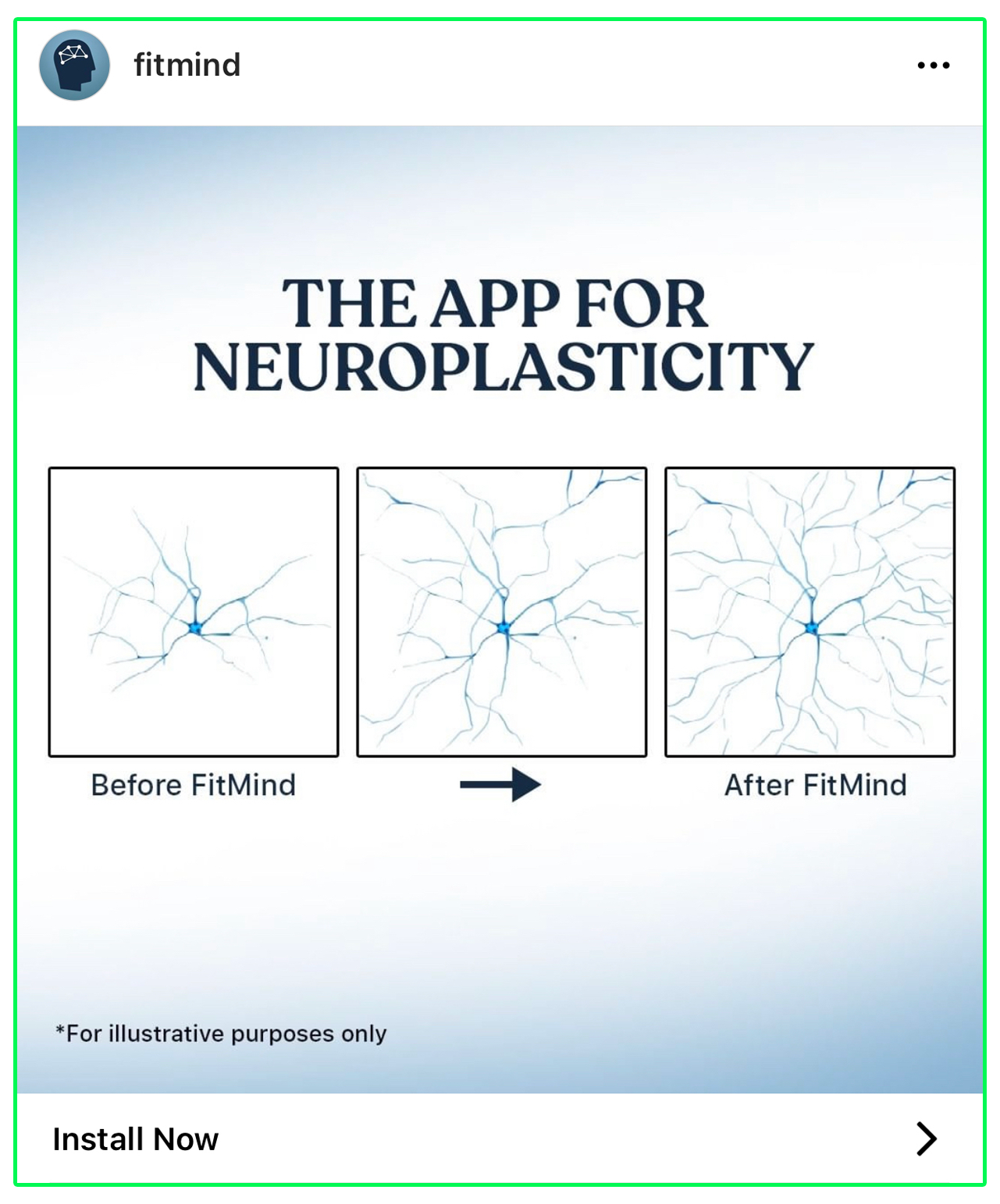 A virtually identical ad to the one by Bloom, except this one is from a company called FitMind, and says “the app for neuroplasticity”. The three panel image also shows a neuron growing dendrites, but it is a different illustration, and the caption under the first panel says Before FitMind, with the caption under the third panel saying After FitMind. The fine print also says “for illustrative purposes only”