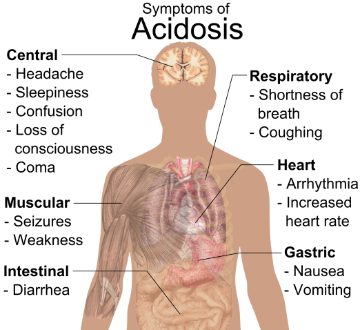 Symptoms of Acidosis