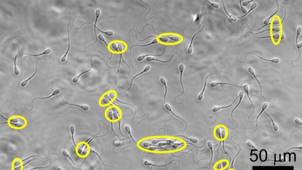 Teams of Sperm Swim More Smoothly Against the Current | Technology Networks