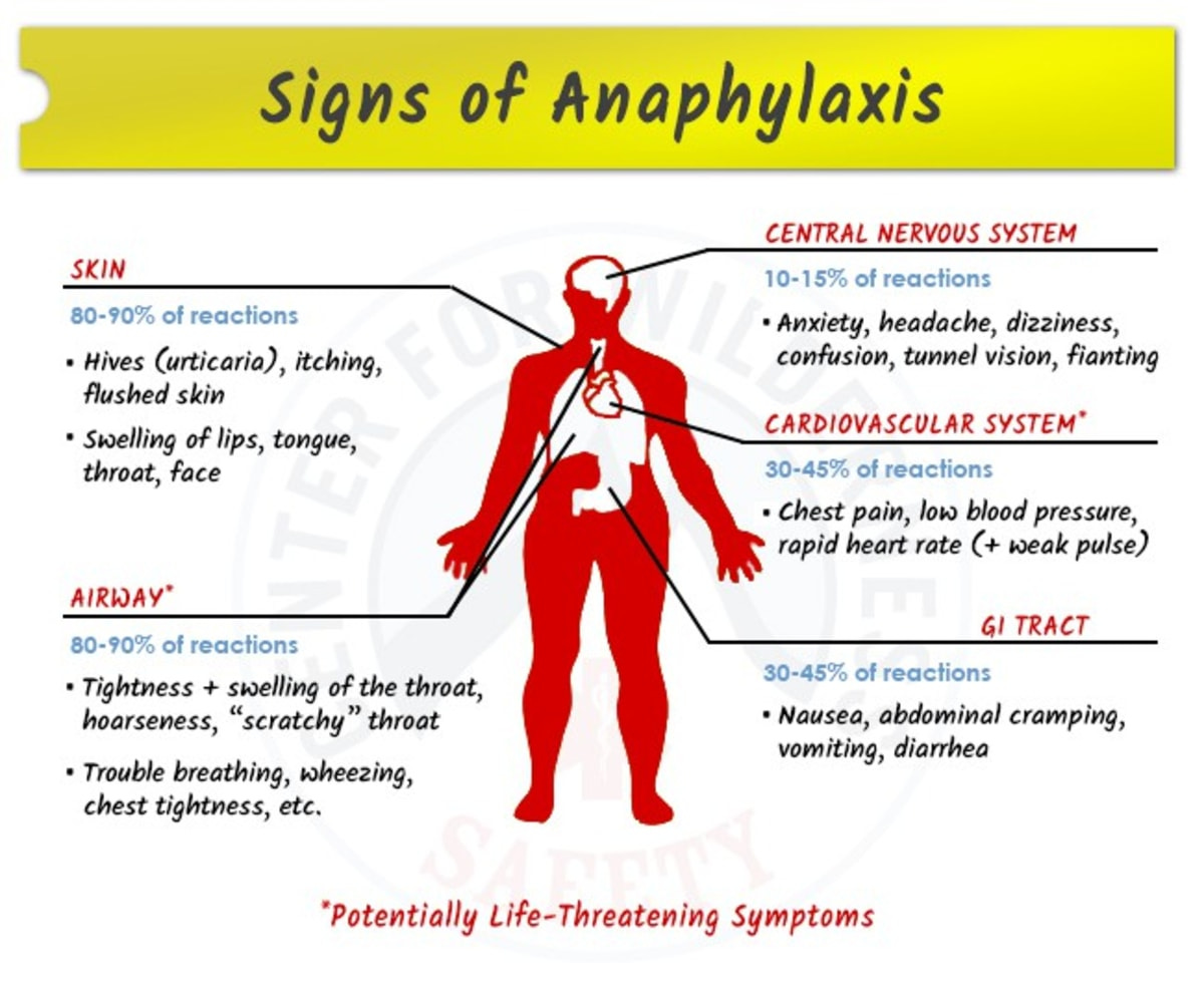 Anaphylaxis - Know More About It! - By Dr. Radhika A (Md) | Lybrate