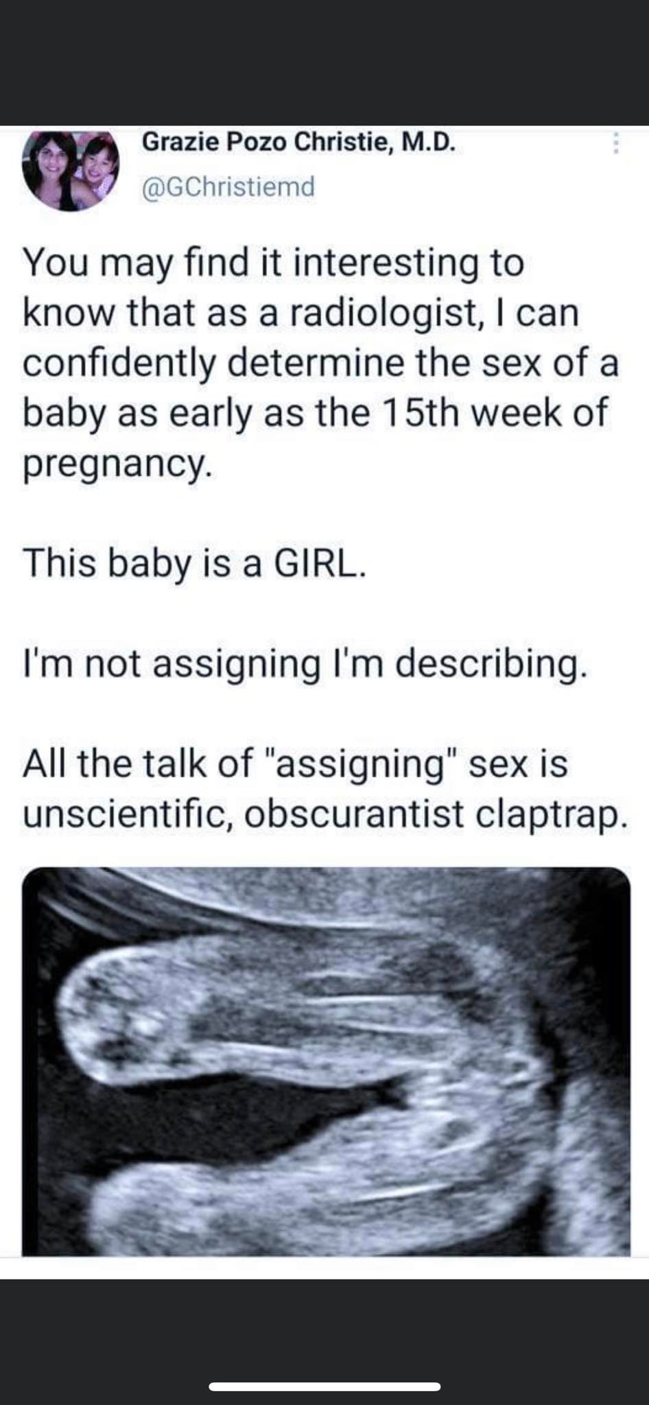 May be an image of text that says 'Grazie Pozo Christie, M.D. @GChristiemd You may find it interesting to know that as a radiologist, can confidently determine the sex of a baby as early as the 15th week of pregnancy. This baby is a GIRL. I'm not assigning I'm describing. All the talk of "assigning" sex is unscientific, obscurantist claptrap.'