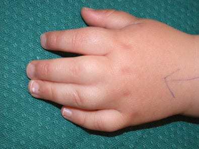 clinical photo of a hand