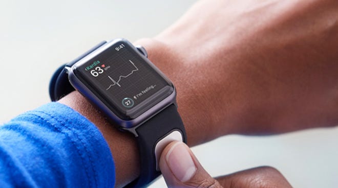 AliveCor pulls KardiaBand ECG smart band for Apple Watch from sale |  AppleInsider