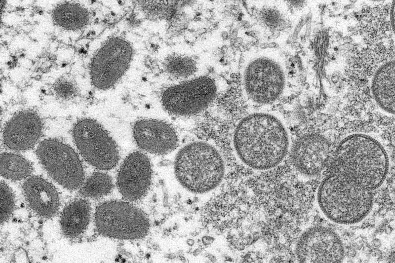 FILE - This 2003 electron microscope image made available by the Centers for Disease Control and Prevention shows mature, oval-shaped monkeypox virions, left, and spherical immature virions, right, obtained from a sample of human skin associated with the 2003 prairie dog outbreak. U.S. health officials are expanding the group of people recommended to get vaccinated against the monkeypox virus. They also say they are providing more monkeypox vaccine, working to expand testing, and taking other steps to try to get ahead of the outbreak.  (Cynthia S. Goldsmith, Russell Regner/CDC via AP, file)