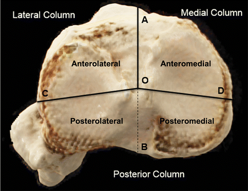 bone morphology of proximal tibia