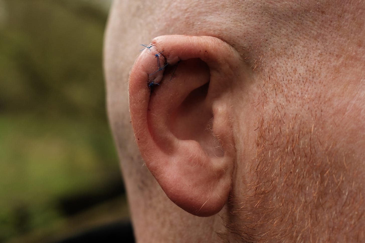 Close-up of sewn up ear.