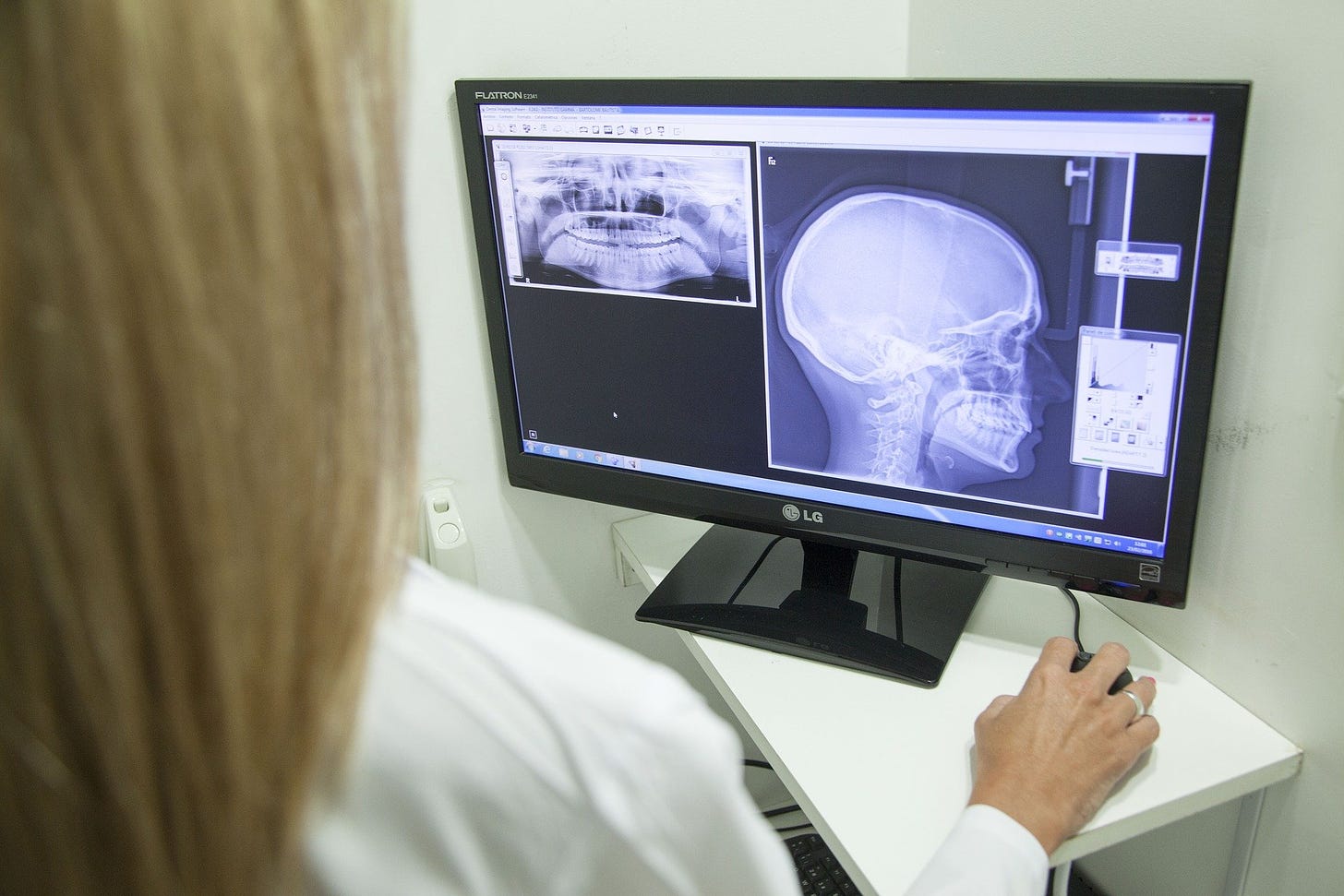 científica viendo radiografía