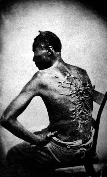 Scars of a whipped slave (April 2, 1863, Baton...