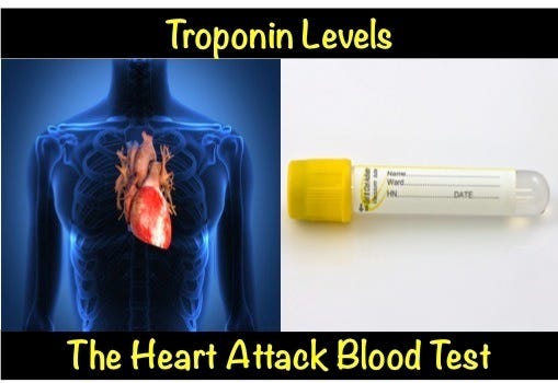 Troponin Levels – The Heart Attack Blood Test myheart.net
