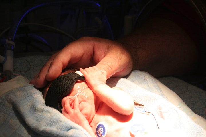 A large male hand covers the head of a very tiny baby. The baby has an eye cover, an oxygen tube and a heart rate monitor patch.
