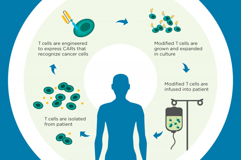 CAR T Cell Therapies Are a Growing Area of Research | Memorial Sloan  Kettering Cancer Center