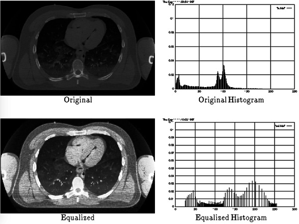 Image Augmentation for Deep Learning using Keras and Histogram Equalization