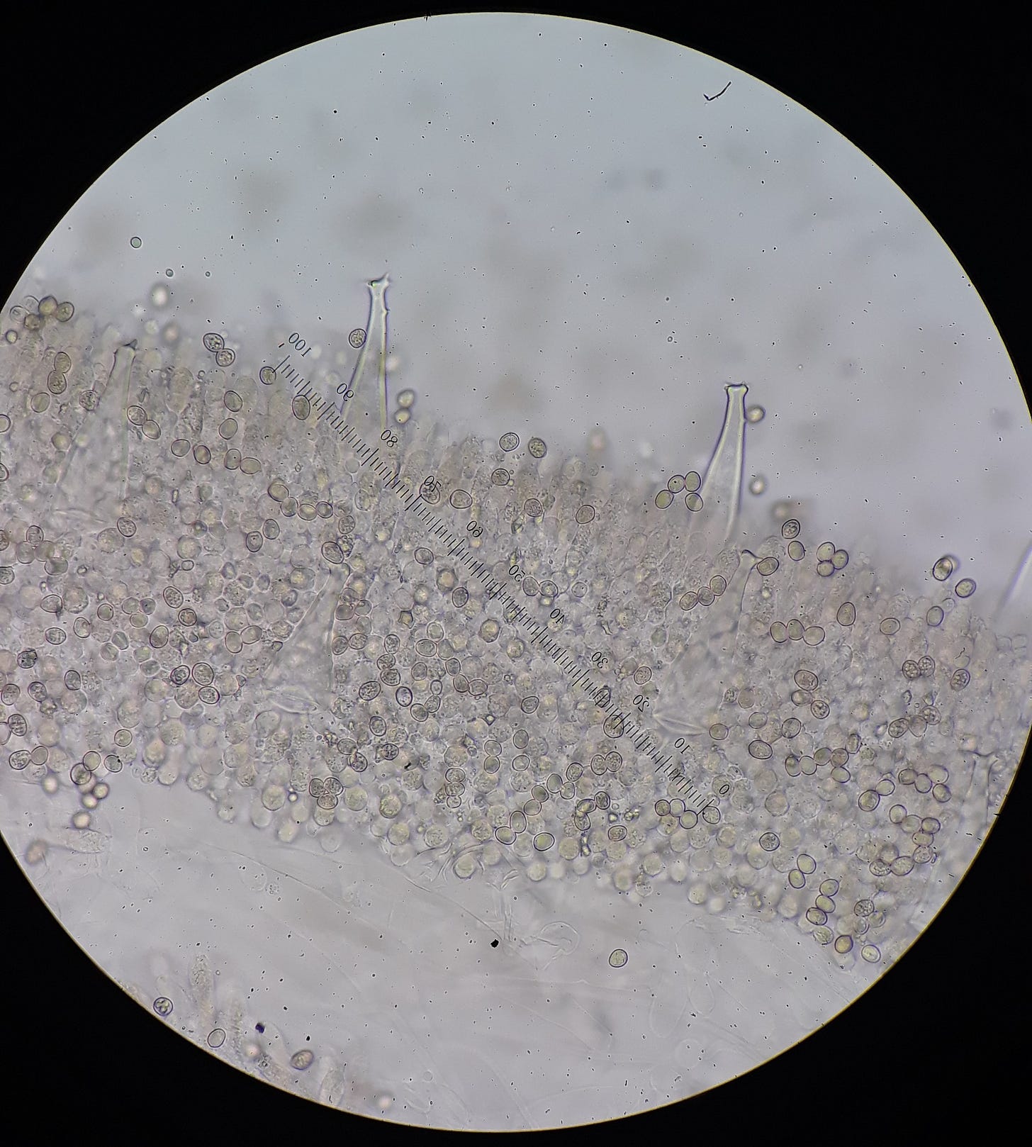 Spherical spores attached to short stubby basidia with long asexual cells standing like pillars from the mass.