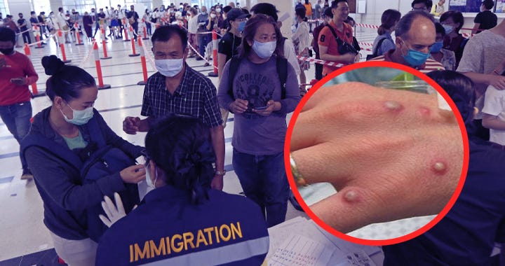 Thailand steps up on screening arrivals to monitor monkeypox virus — Pinoy  Thaiyo