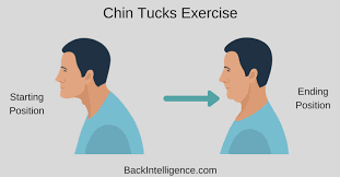 How To Fix Forward Head Posture - 5 Exercises And Stretches | Forward head  posture, Chin tuck, Forward head posture correction